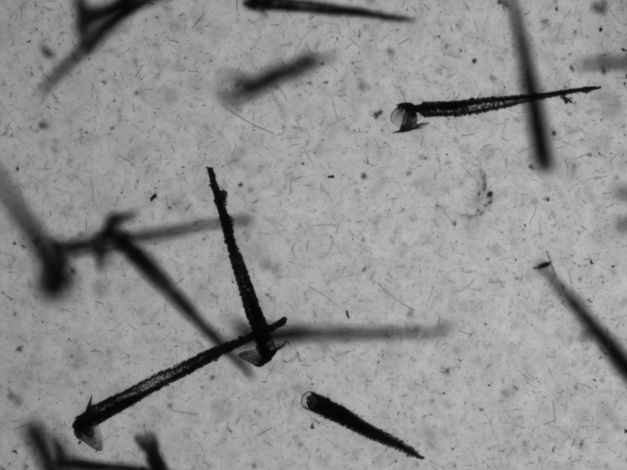 planktonscope%e7%9b%91%e6%b5%8b%e5%88%b0%e7%9a%84%e5%b0%96%e7%ac%94%e5%b8%bd%e8%9e%ba%e5%9b%be%e5%83%8f